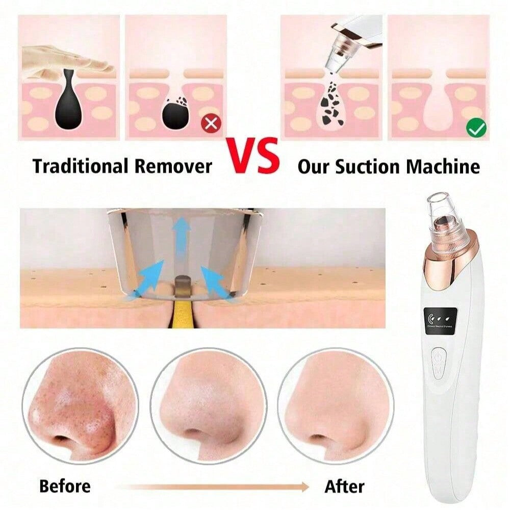 ZENQO™ – Electric Acne Pore Cleaner & Blackhead Remover